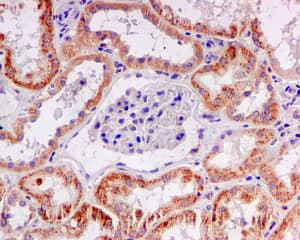 Antikörper für die Pathologie