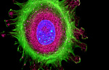 Mounting Media for fluorescent microscopy